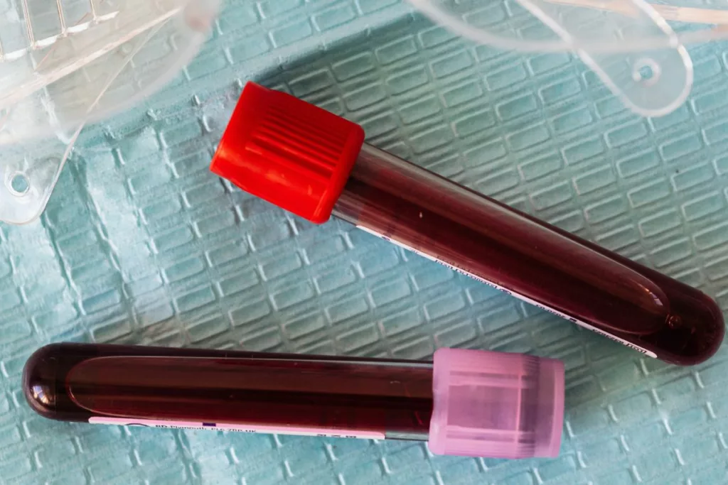 Nicotine blood test tubes