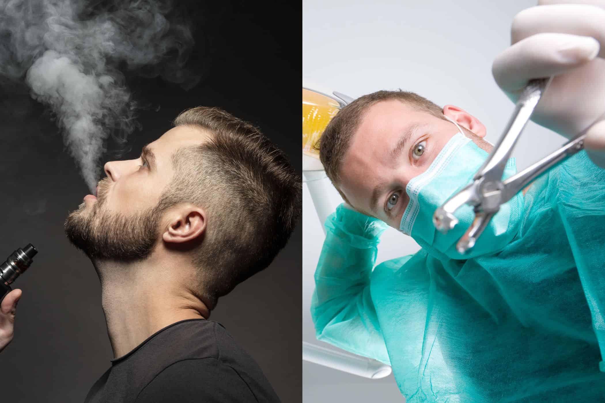 A man vaping after tooth extraction with gauz